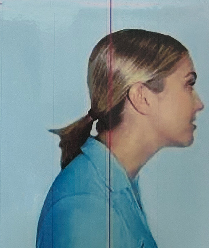 POOR POSTURE